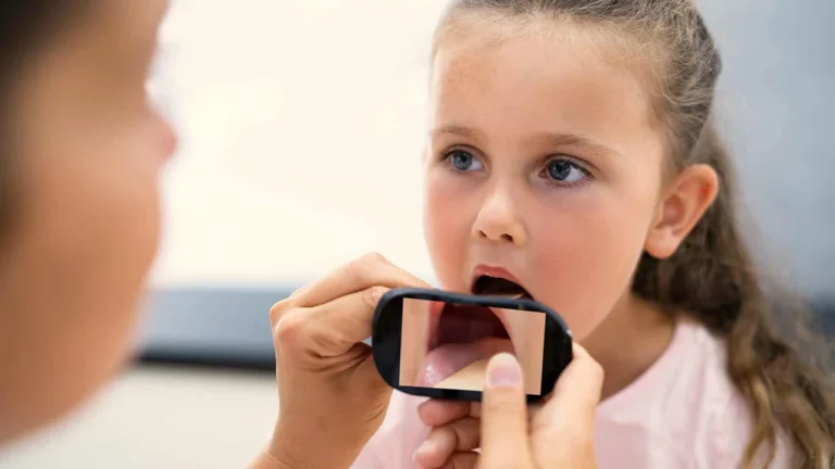 Pontos Essenciais para Entender o que é Disfagia na Paralisia Cerebral e Como Identificar