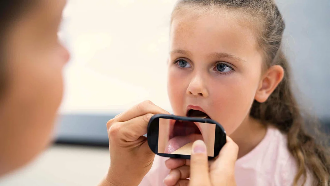 Pontos Essenciais para Entender o que é Disfagia na Paralisia Cerebral e Como Identificar