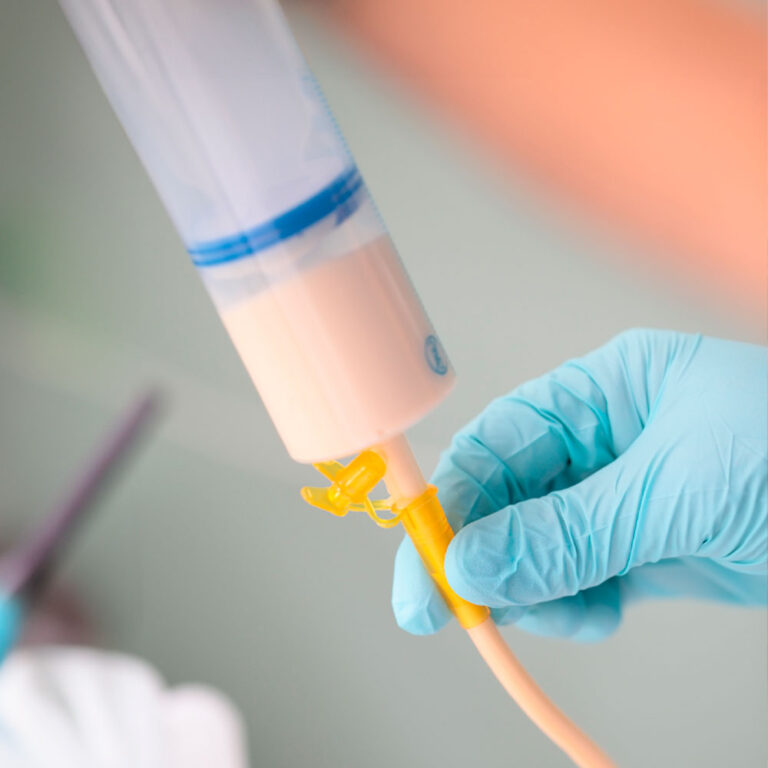 Receita Adaptada Simples e Segura para Crianças que Usam Gastrostomia